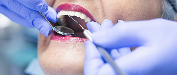 Best Broken Tooth Emergency  in Squaw Valley, CA